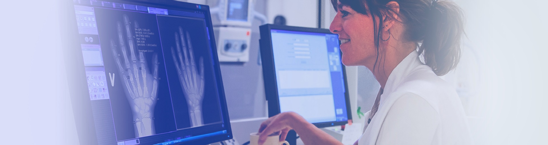 Bone Age assesment software based on standards - BoneXpert