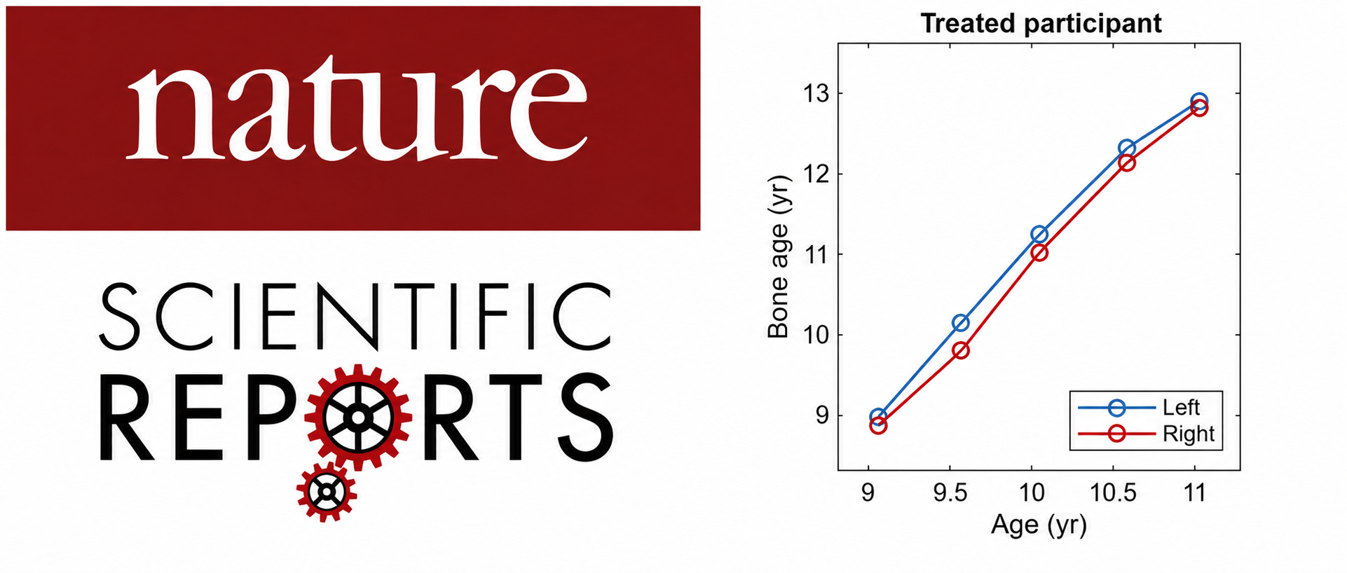 New Study: BoneXpert bone age has a precision of 0.08 years
