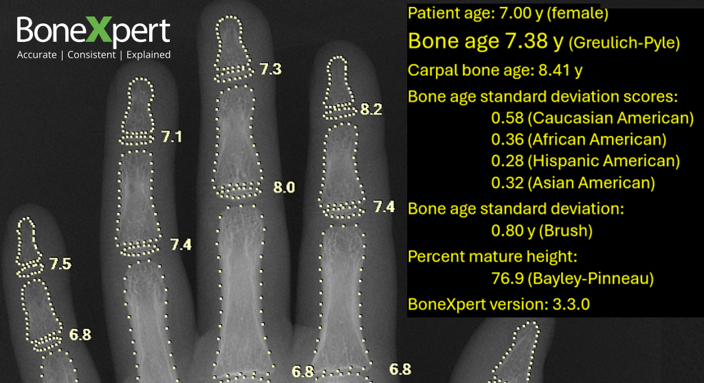 Visiana receives FDA510(k) clearance for BoneXpert bone age software